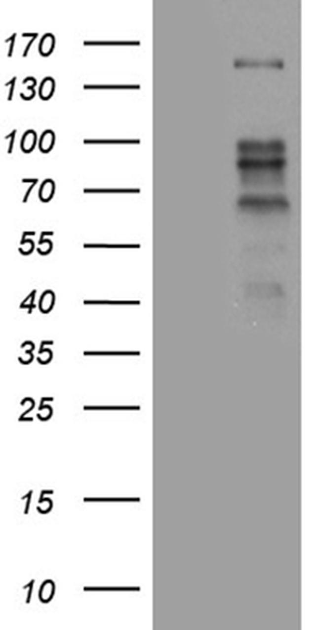 ZBTB4 Antibody in Western Blot (WB)