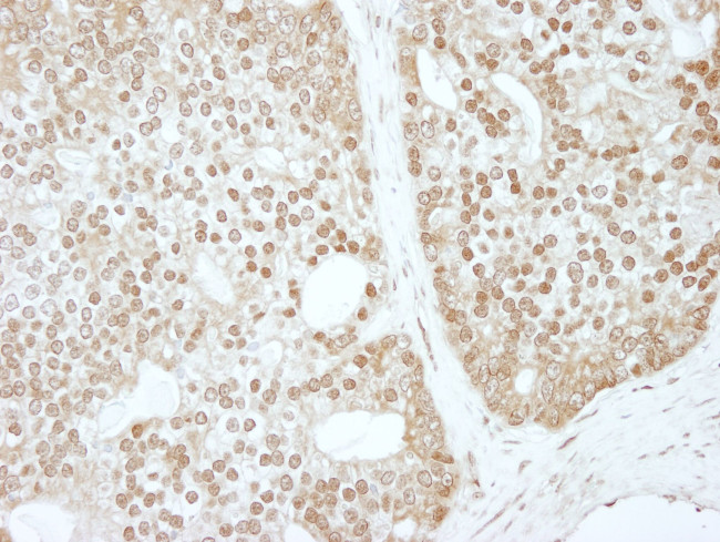 ZBTB40 Antibody in Immunohistochemistry (IHC)