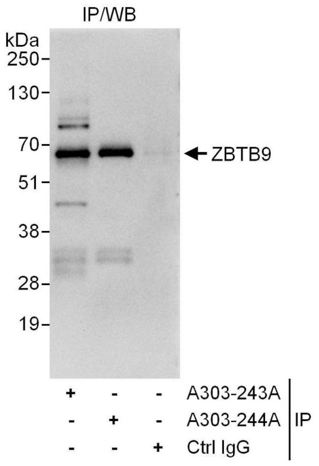 ZBTB9 Antibody in Immunoprecipitation (IP)