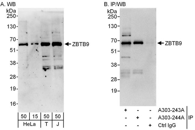 ZBTB9 Antibody in Western Blot (WB)