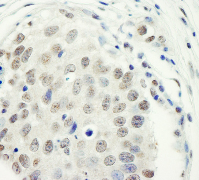 ZC3H11A Antibody in Immunohistochemistry (IHC)