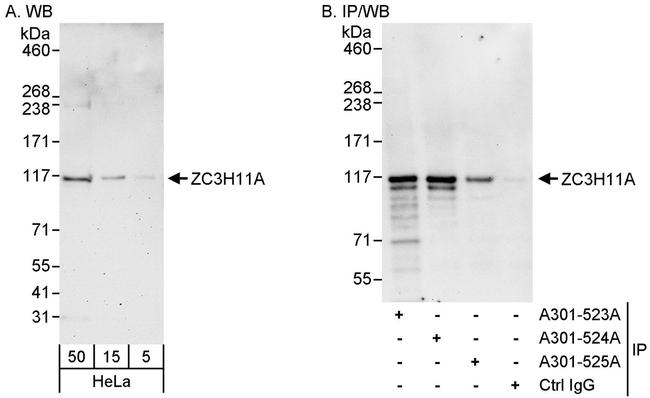 ZC3H11A Antibody in Western Blot (WB)