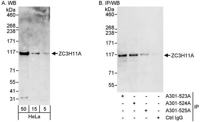 ZC3H11A Antibody in Western Blot (WB)