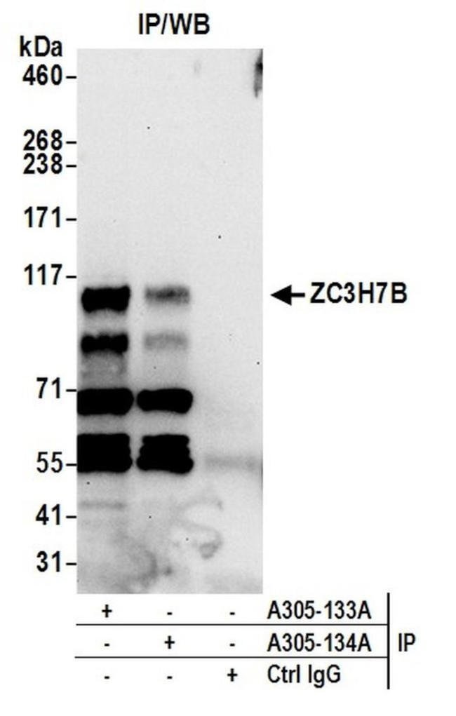 ZC3H7B Antibody in Immunoprecipitation (IP)