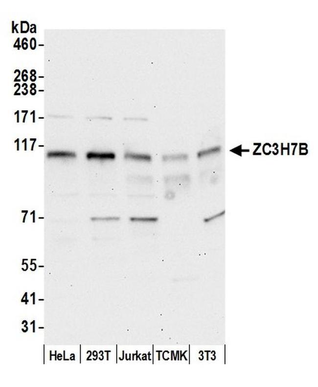 ZC3H7B Antibody in Western Blot (WB)