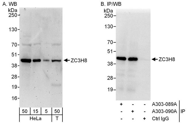 ZC3H8 Antibody in Western Blot (WB)