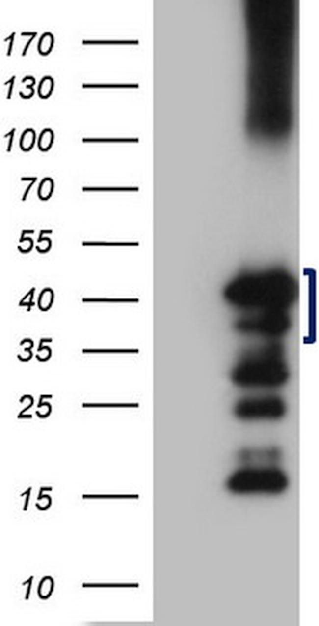 ZC3H8 Antibody in Western Blot (WB)