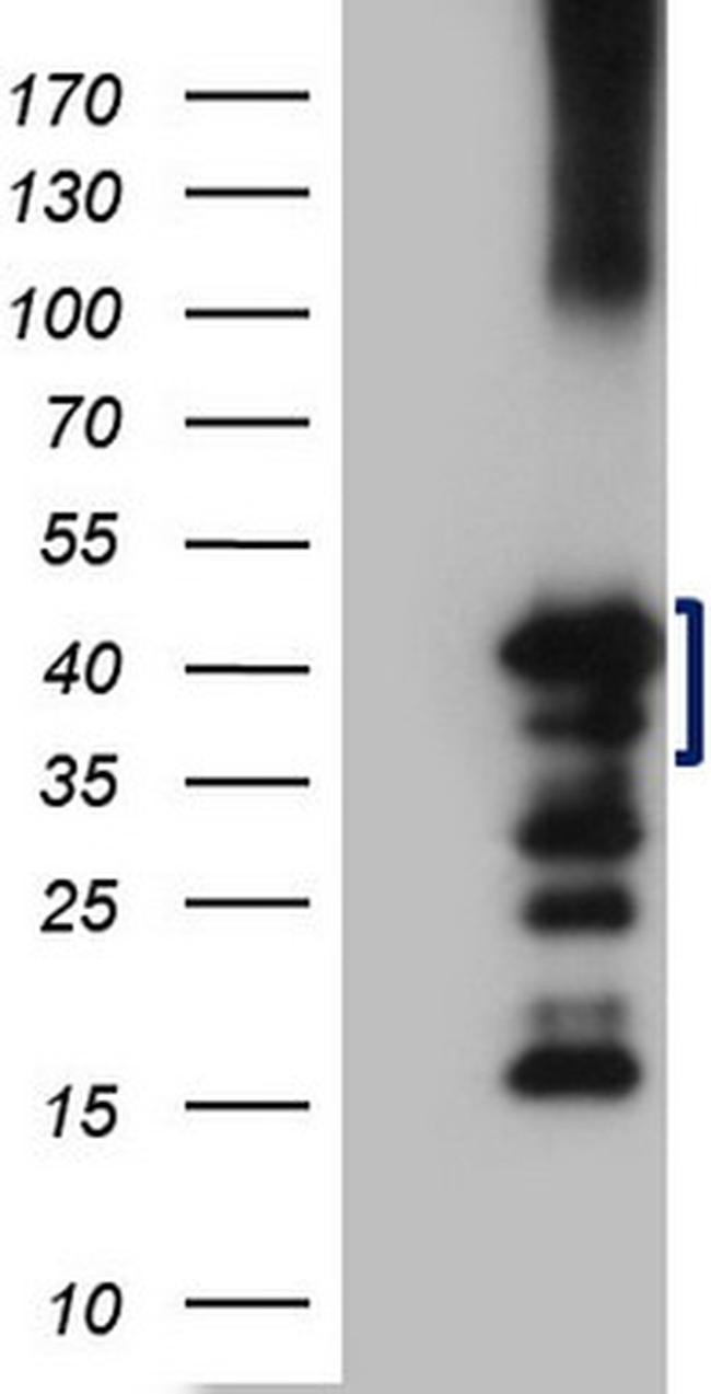 ZC3H8 Antibody in Western Blot (WB)