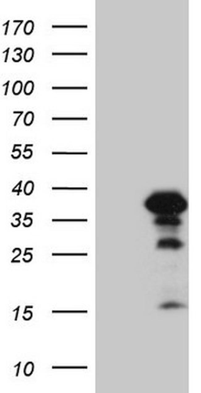 ZC3H8 Antibody in Western Blot (WB)