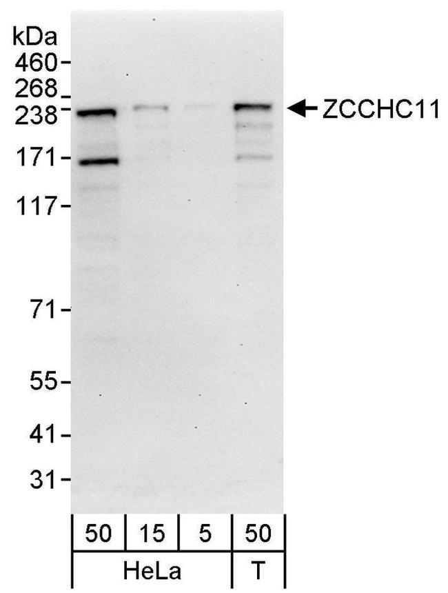 ZCCHC11 Antibody in Western Blot (WB)