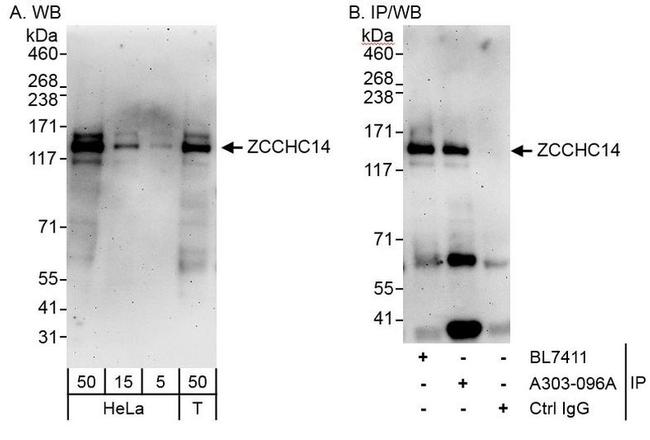 ZCCHC14 Antibody in Western Blot (WB)