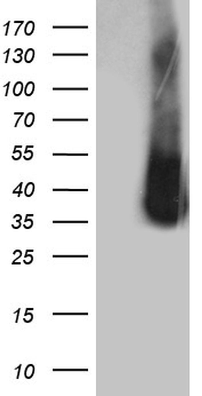 ZCCHC17 Antibody in Western Blot (WB)