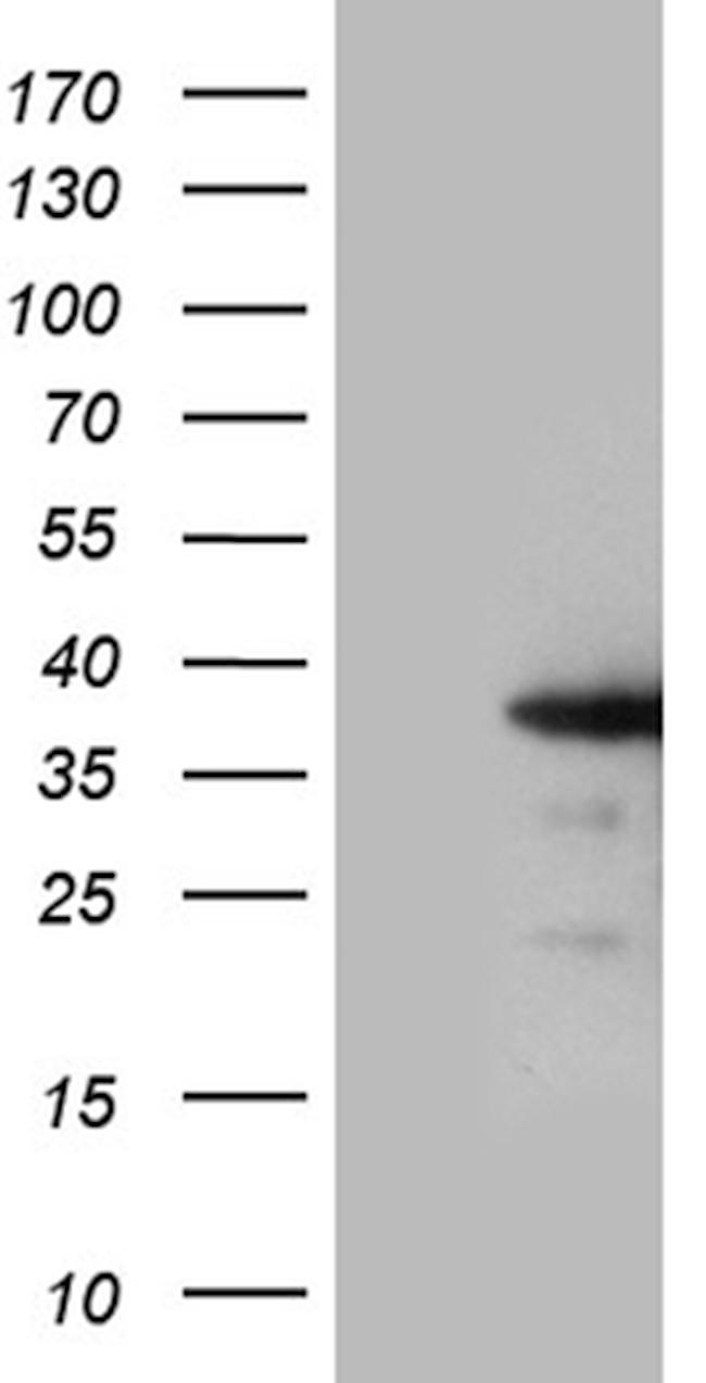 ZCCHC17 Antibody in Western Blot (WB)