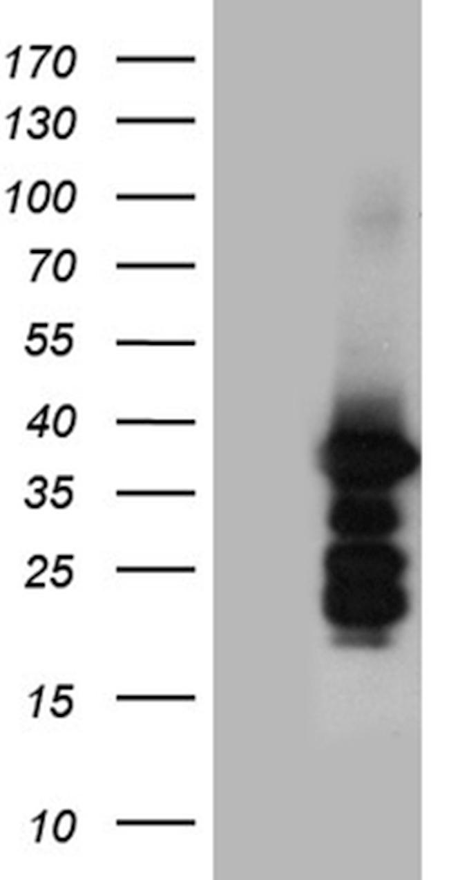 ZCCHC17 Antibody in Western Blot (WB)