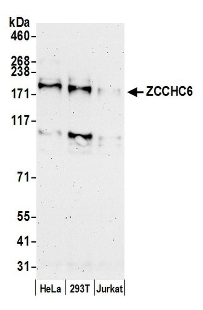 ZCCHC6 Antibody in Western Blot (WB)