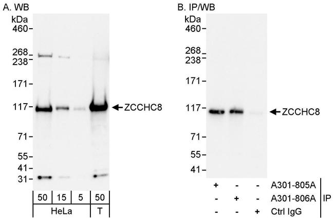 ZCCHC8 Antibody in Western Blot (WB)