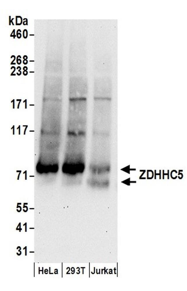 ZDHHC5 Antibody in Western Blot (WB)