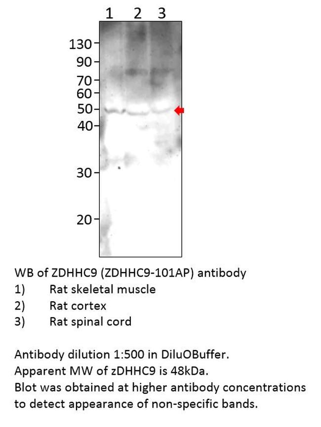 ZDHHC9 Antibody in Western Blot (WB)