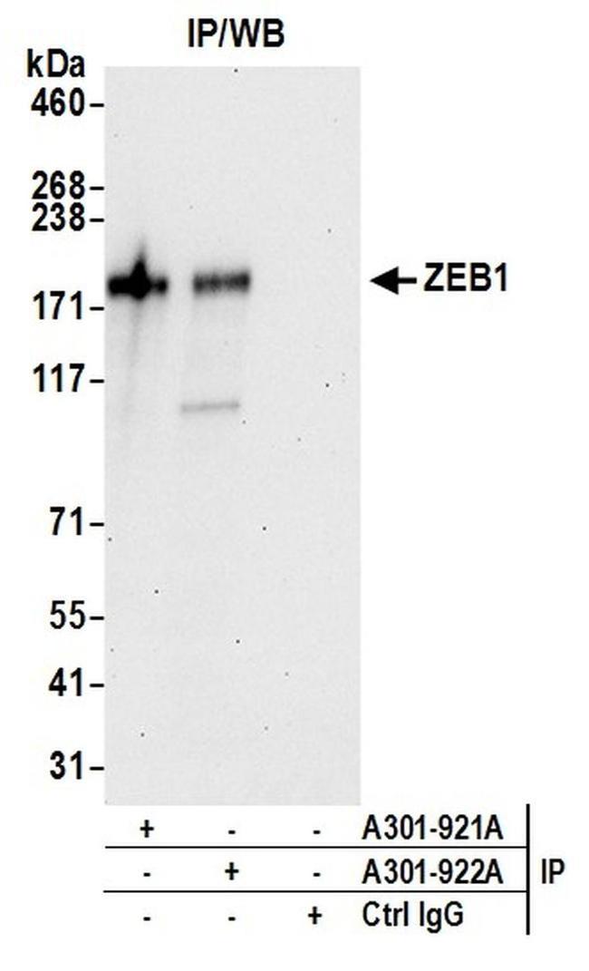 ZEB1 Antibody in Western Blot (WB)