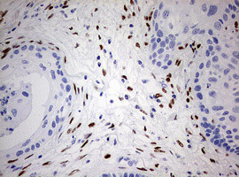 ZEB1 Antibody in Immunohistochemistry (Paraffin) (IHC (P))