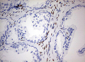 ZEB1 Antibody in Immunohistochemistry (Paraffin) (IHC (P))