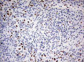 ZEB1 Antibody in Immunohistochemistry (Paraffin) (IHC (P))