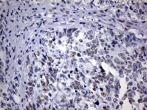 ZEB1 Antibody in Immunohistochemistry (Paraffin) (IHC (P))