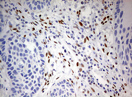 ZEB1 Antibody in Immunohistochemistry (Paraffin) (IHC (P))