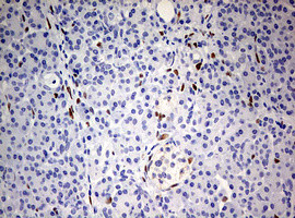 ZEB1 Antibody in Immunohistochemistry (Paraffin) (IHC (P))