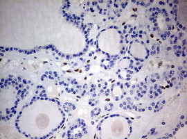 ZEB1 Antibody in Immunohistochemistry (Paraffin) (IHC (P))