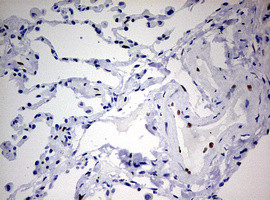 ZEB1 Antibody in Immunohistochemistry (Paraffin) (IHC (P))