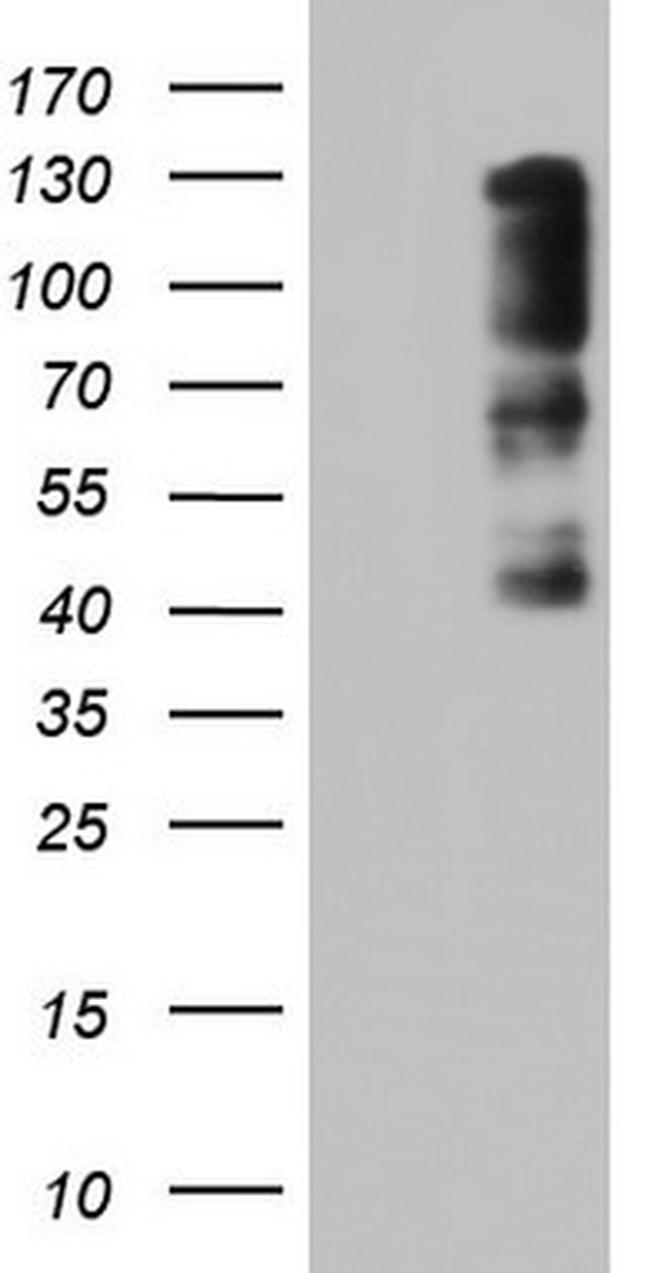 ZEB1 Antibody in Western Blot (WB)