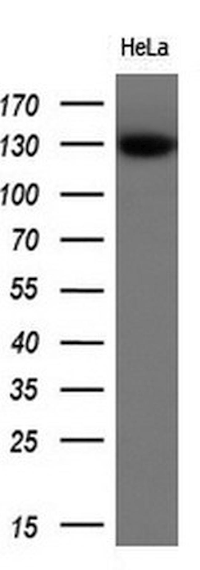 ZEB1 Antibody in Western Blot (WB)