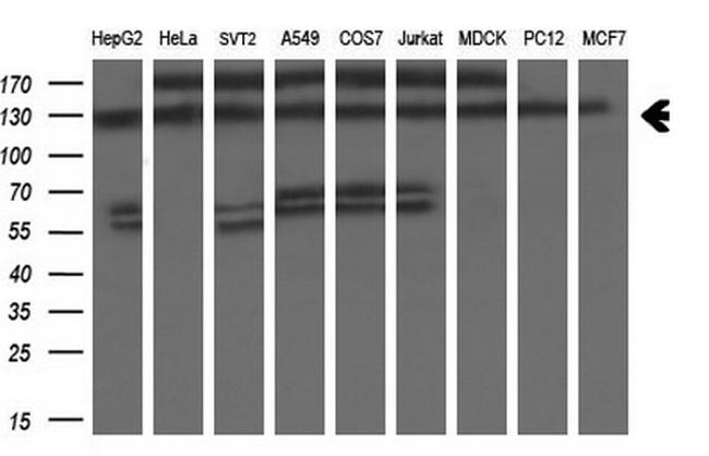 ZEB1 Antibody in Western Blot (WB)