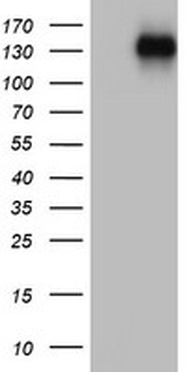 ZEB1 Antibody in Western Blot (WB)