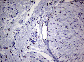 ZEB2 Antibody in Immunohistochemistry (Paraffin) (IHC (P))