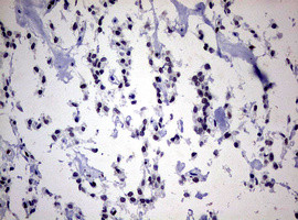 ZEB2 Antibody in Immunohistochemistry (Paraffin) (IHC (P))