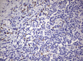 ZEB2 Antibody in Immunohistochemistry (Paraffin) (IHC (P))