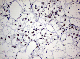 ZEB2 Antibody in Immunohistochemistry (Paraffin) (IHC (P))