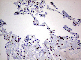 ZEB2 Antibody in Immunohistochemistry (Paraffin) (IHC (P))