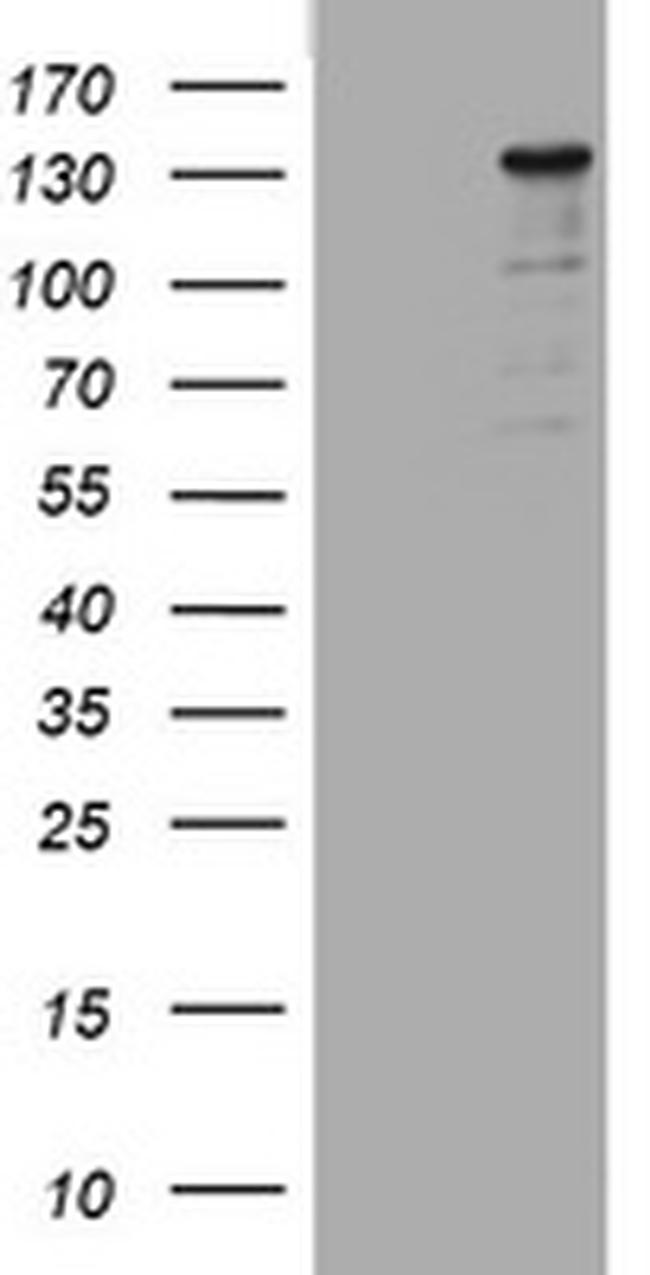 ZEB2 Antibody in Western Blot (WB)