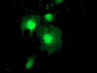 ZFAND2B Antibody in Immunocytochemistry (ICC/IF)