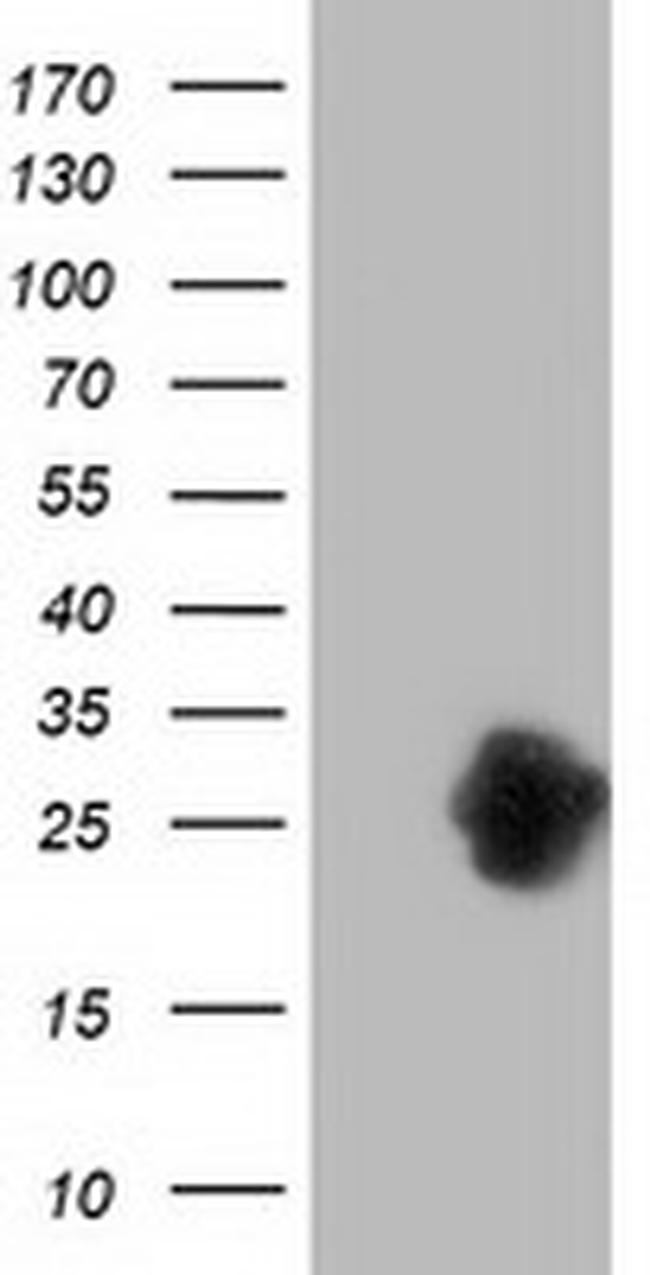 ZFAND2B Antibody in Western Blot (WB)