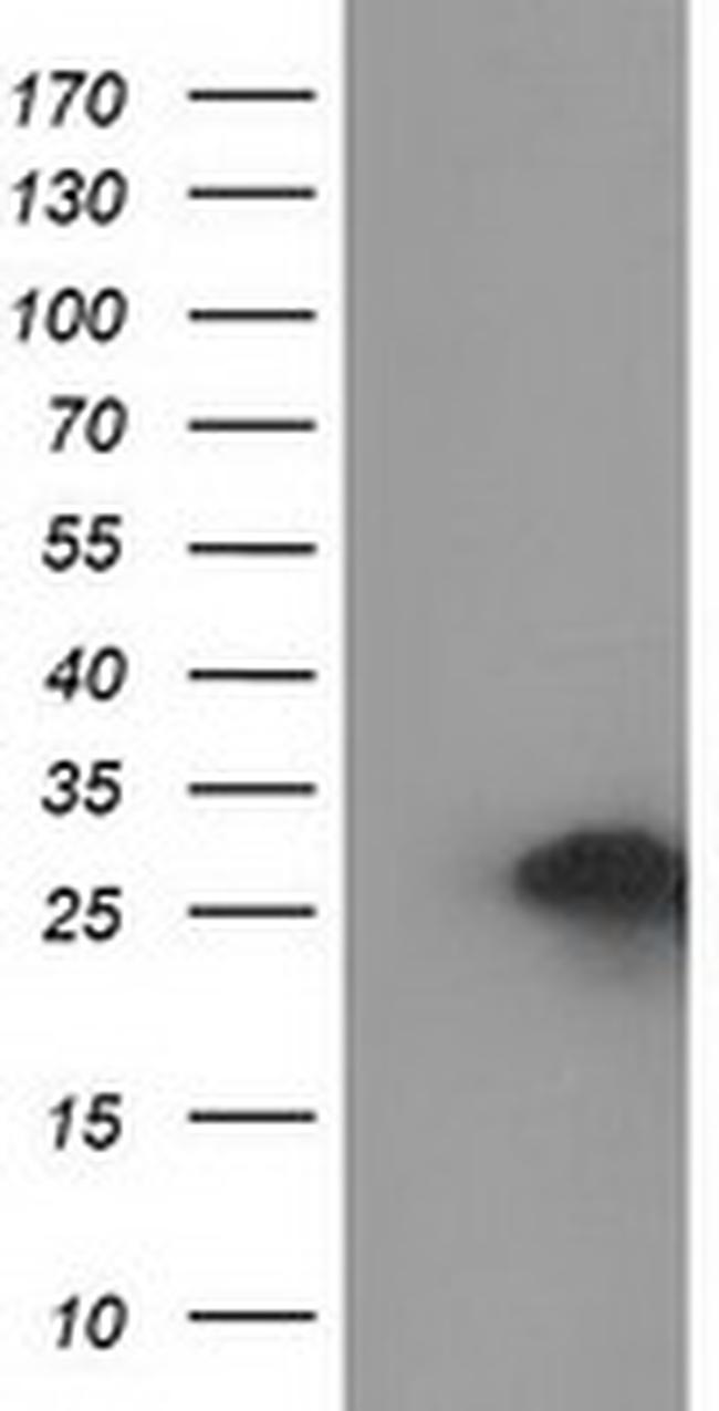 ZFAND2B Antibody in Western Blot (WB)