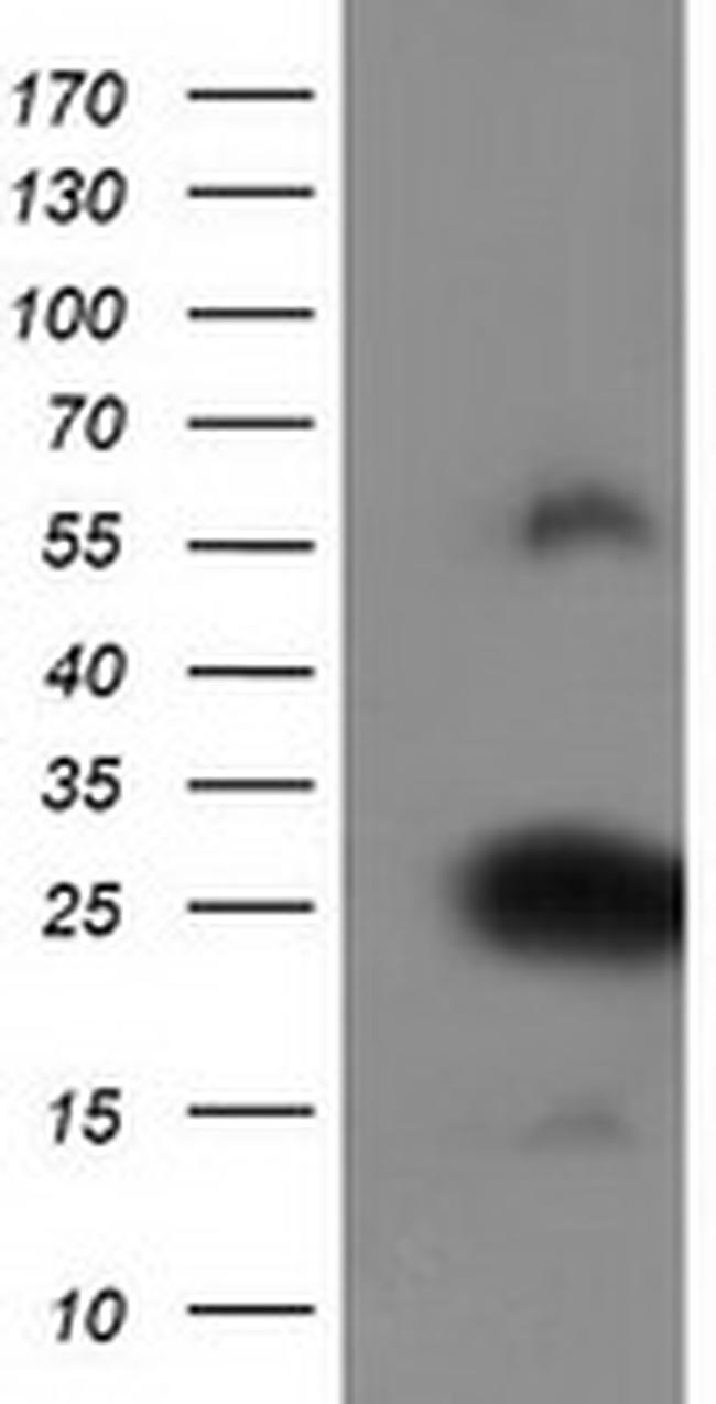 ZFAND2B Antibody in Western Blot (WB)