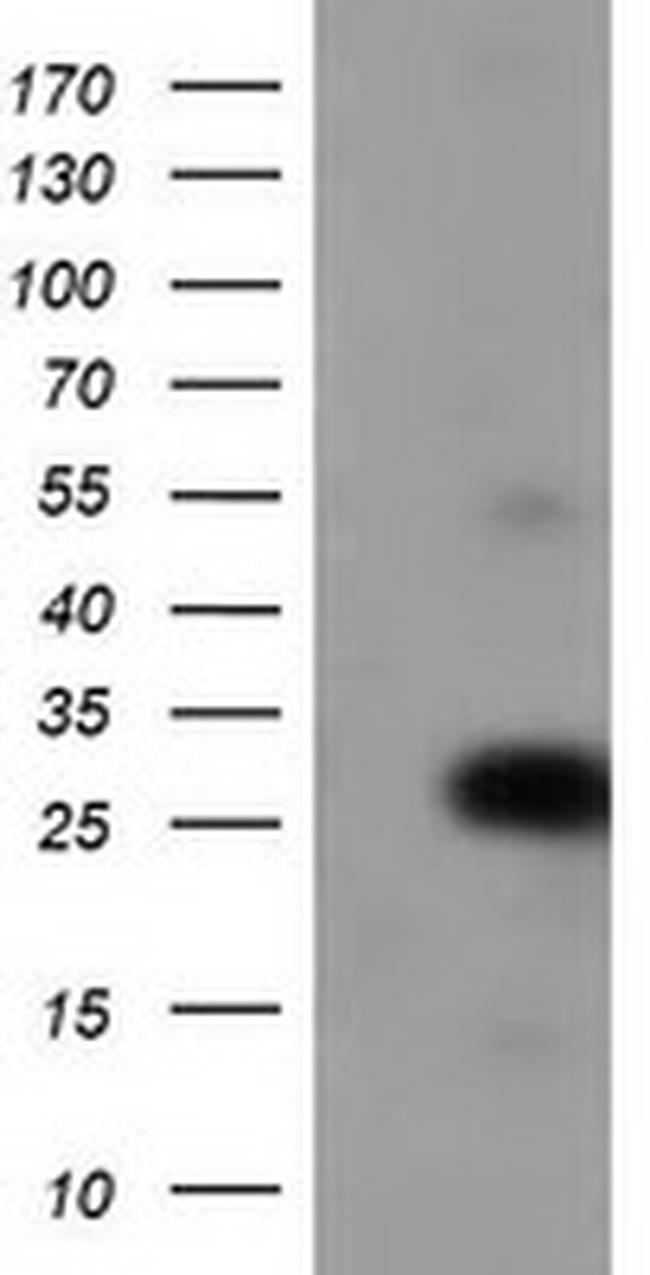 ZFAND2B Antibody in Western Blot (WB)