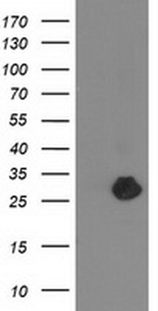 ZFAND2B Antibody in Western Blot (WB)