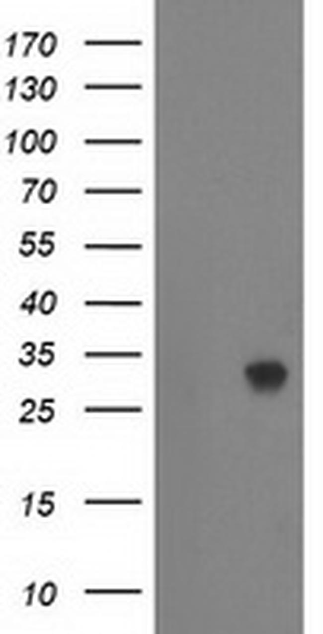 ZFAND2B Antibody in Western Blot (WB)