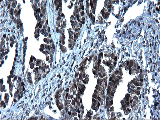 ZFAND3 Antibody in Immunohistochemistry (Paraffin) (IHC (P))