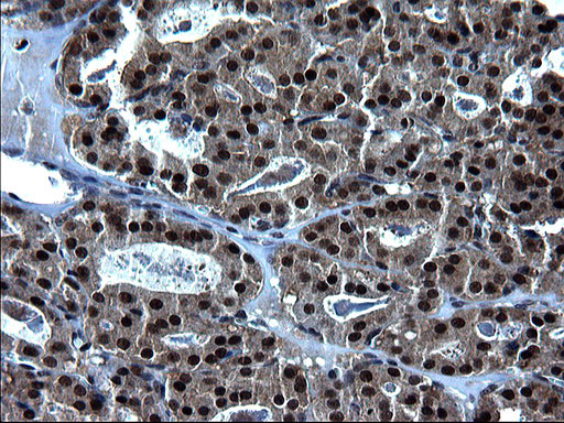 ZFAND3 Antibody in Immunohistochemistry (Paraffin) (IHC (P))